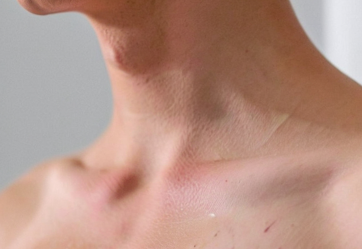 one closeupphotoAbareneckand_4585006-cropped.jpg image